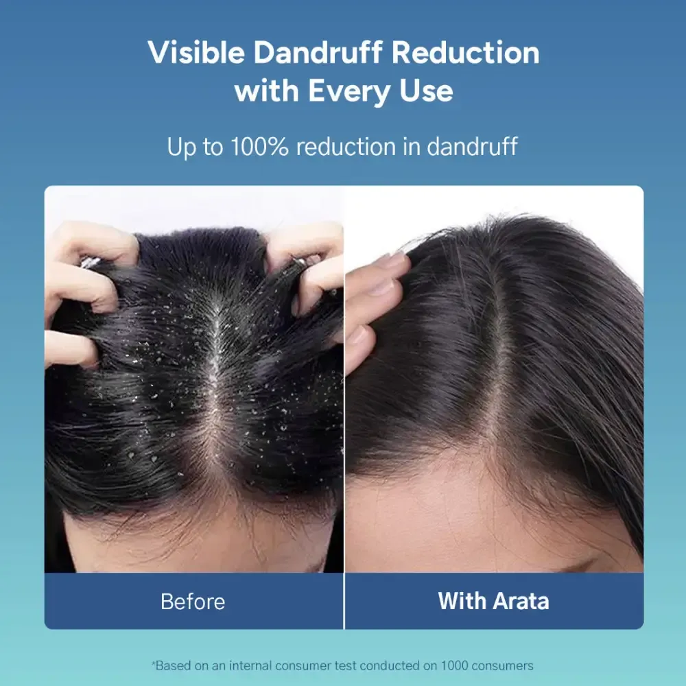 Anti-Dandruff Shampoo (Normal to Oily Hair) AFL - Image 3
