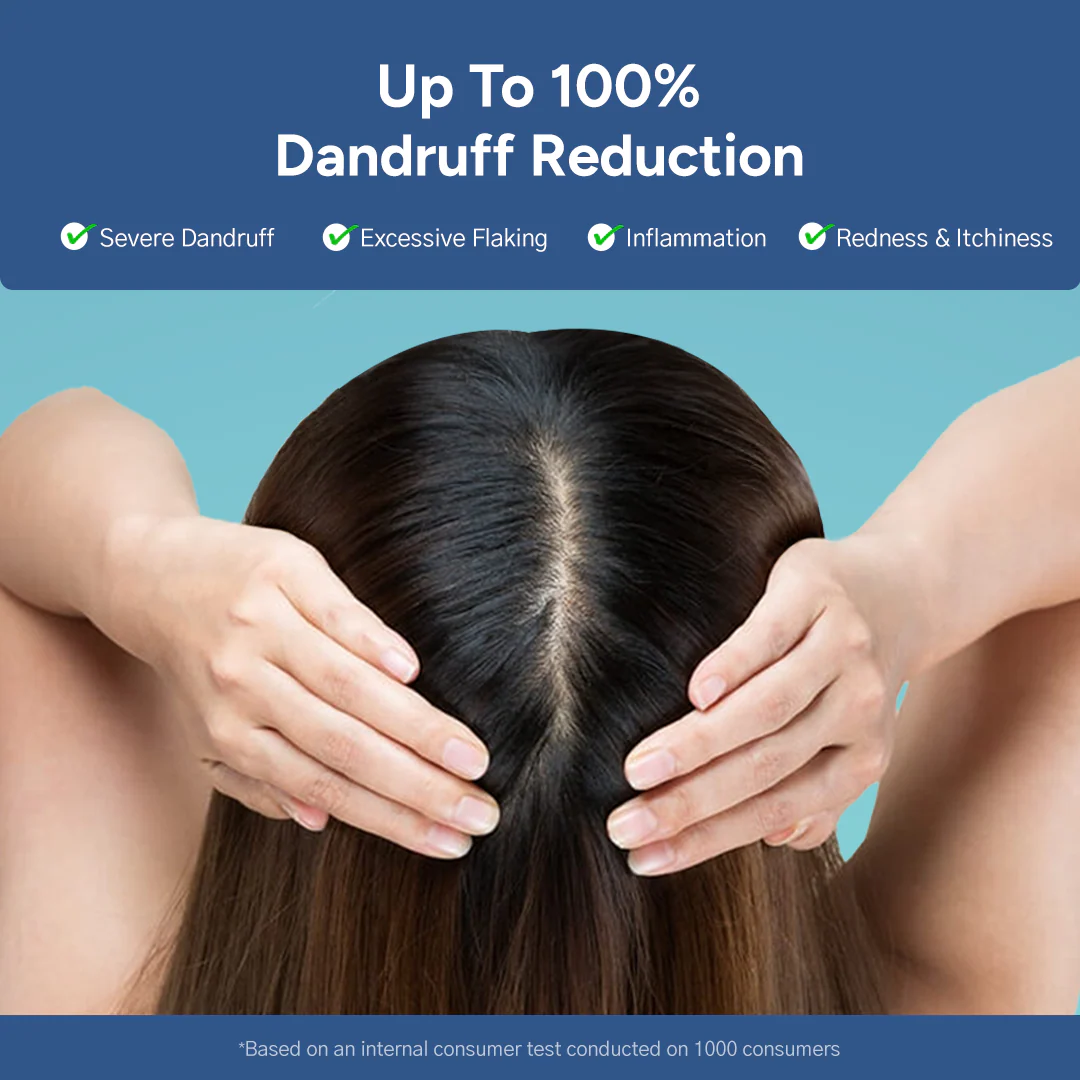 Arata Anti-Dandruff Shampoo, Tonic Combo | Piroctone Olamine & Glycolic Acid | Up To 100% Dandruff Reduction | 200+100ml - Image 5