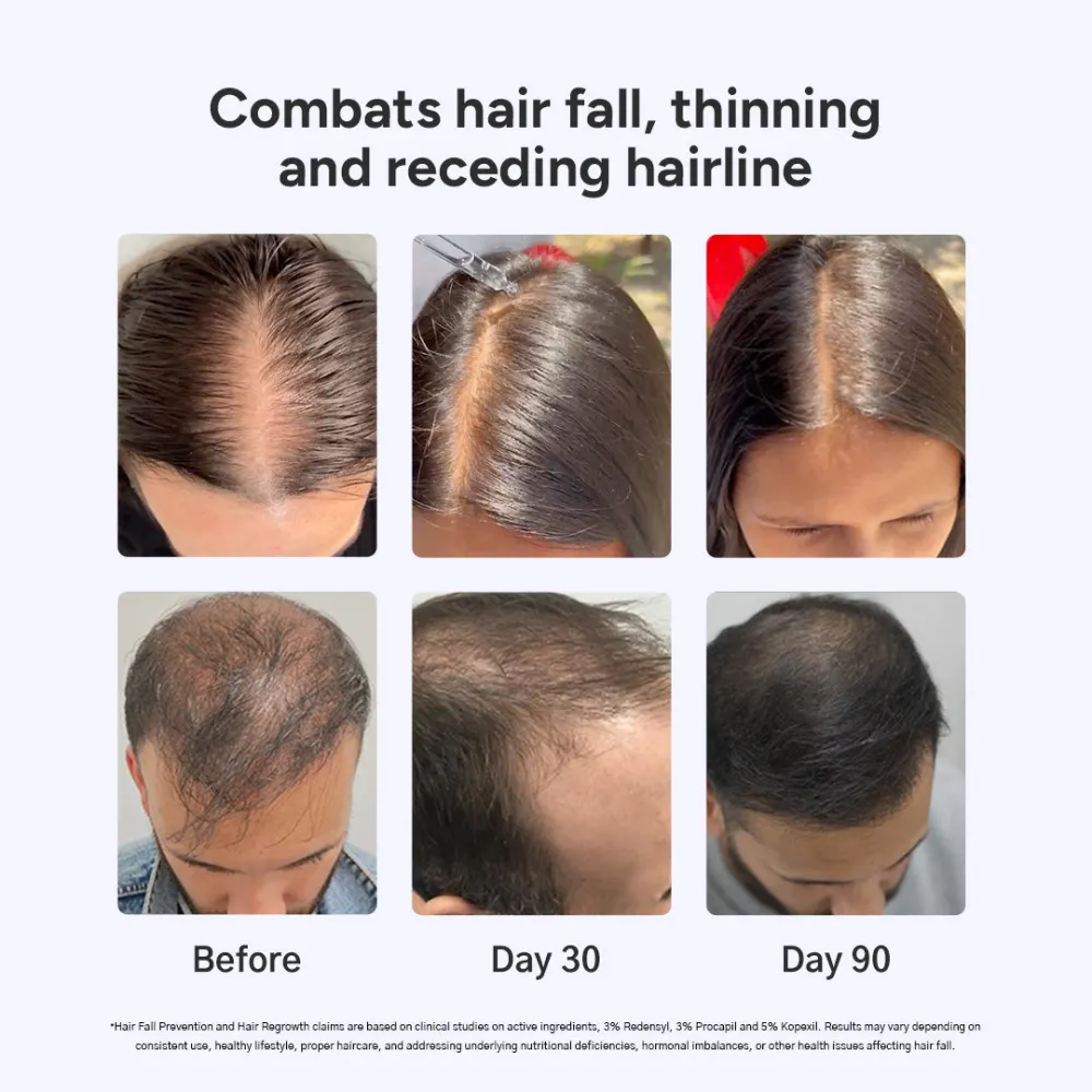Arata 60-Day Value Pack for Fuller, Denser, Thicker Hair Regrowth | Intensive Hair Growth Serum (Pack of 2) - Image 4